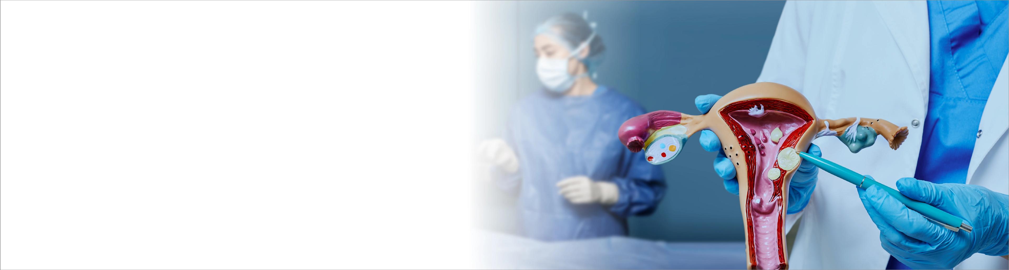 Expert Gynaecologist Consultation in Hyderabad