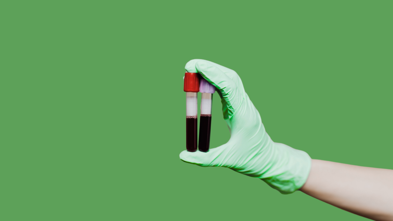 Routine blood tests by GVK HealthHub