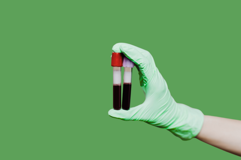 The Role of Routine Blood Tests in Preventive Medicine